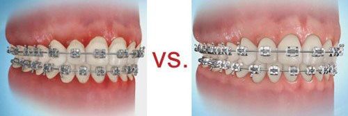 flossing1