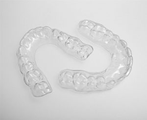 clear aligner